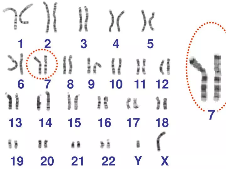 Ppt Look At The Spread Of Human Chromosomes Called Karyotype