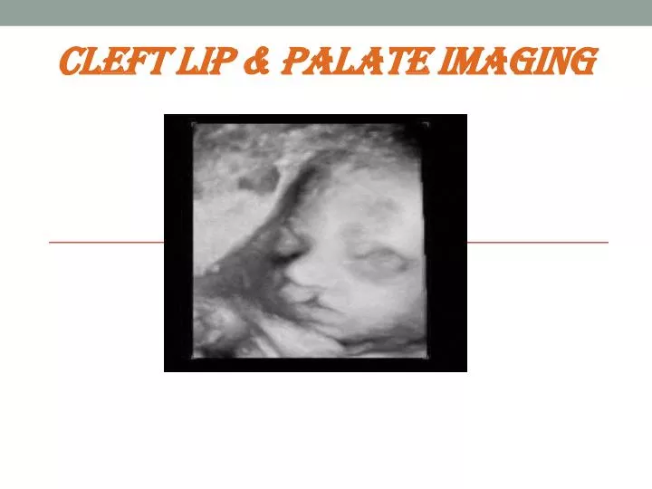 PPT Cleft Lip Palate Imaging PowerPoint Presentation Free Download 
