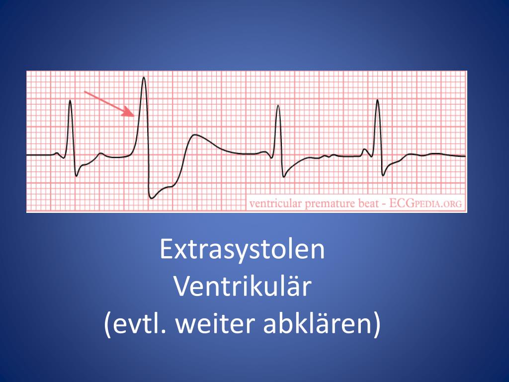 PPT - Herzlich Willkommen! zu: EKG verstehen und bewerten PowerPoint