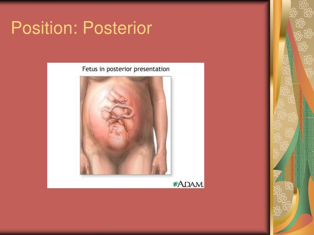 Posterior Presentation