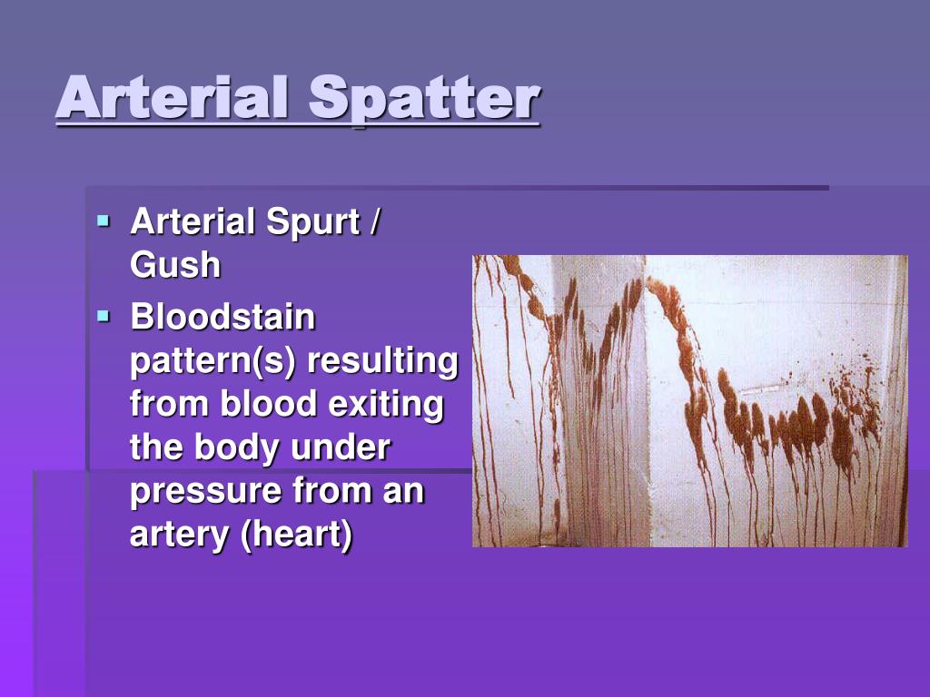 Arterial Spatter arterial-spatter