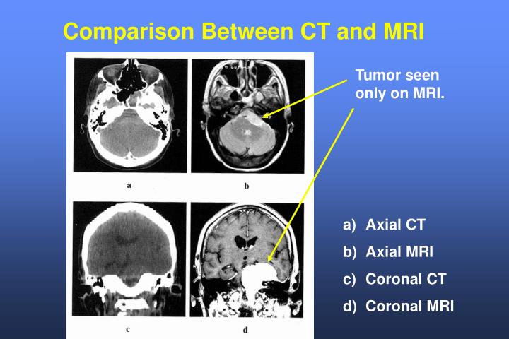 PPT - Physics and Imaging in Radiation Therapy PowerPoint Presentation ...