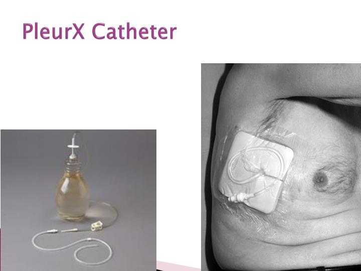 Ppt Chest Tubes Powerpoint Presentation Id3090007 