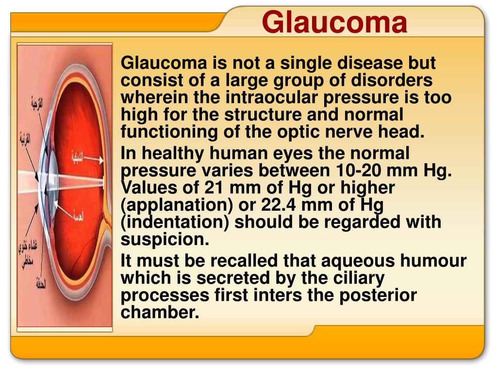 case presentation glaucoma