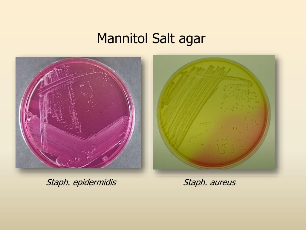 Staphylococcus aureus среда. Маннит солевой агар стафилококк. Стафилококк каталаза. Стафилококк ауреус и эпидермидис. Расщепление маннита стафилококком.