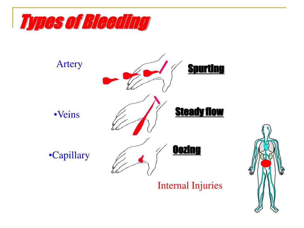 Types Of Bleeding