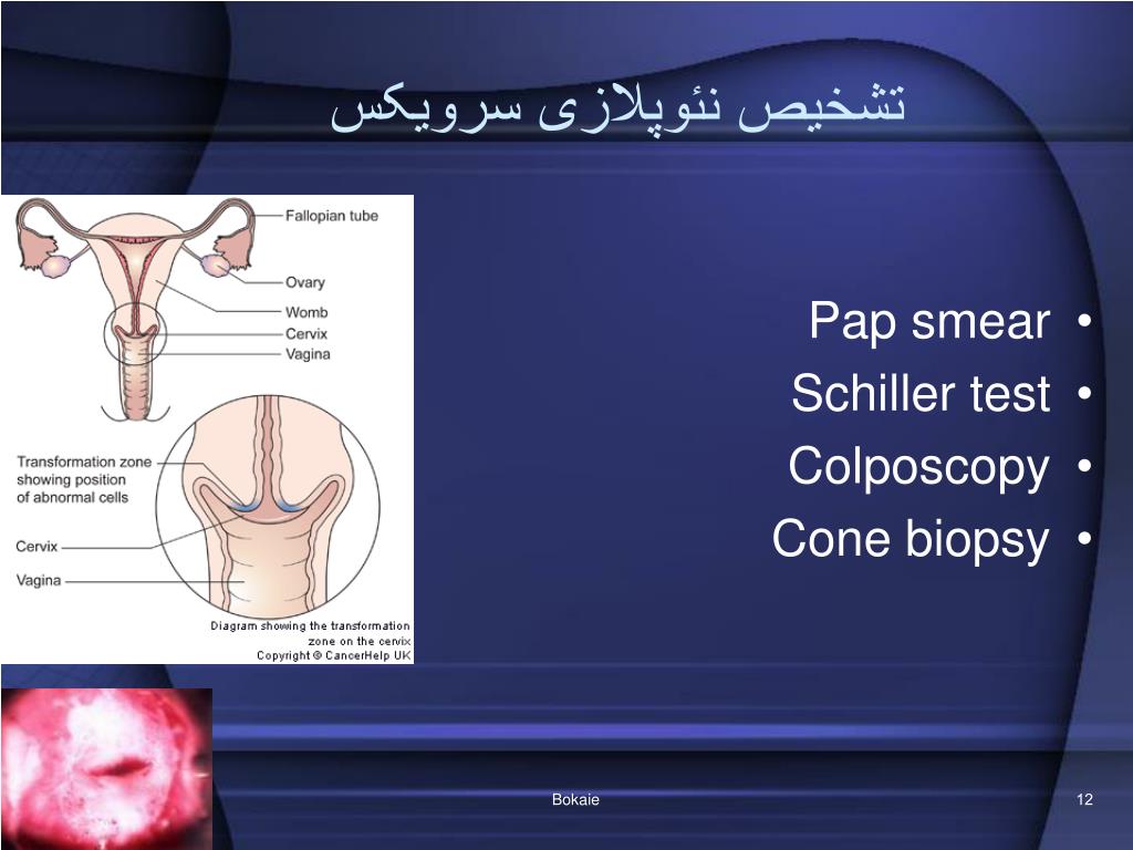 PPT - pap smear M. Bokaie (MS) Shahid sadougi university of medical ...