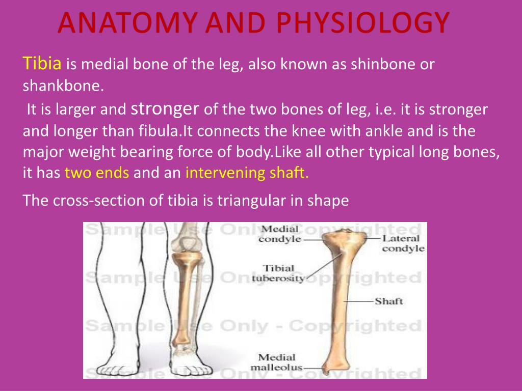 PPT - CASE PRESENTATION ON TIBIAL FRACTURE PowerPoint Presentation