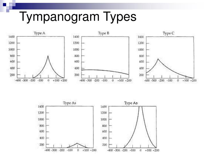 PPT Objective Tests of the Auditory System PowerPoint Presentation