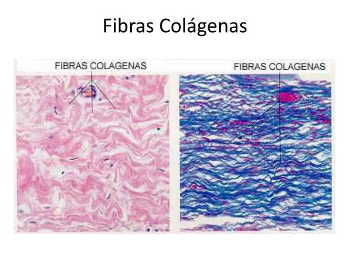 PPT - Tejido Conectivo PowerPoint Presentation - ID:3118133