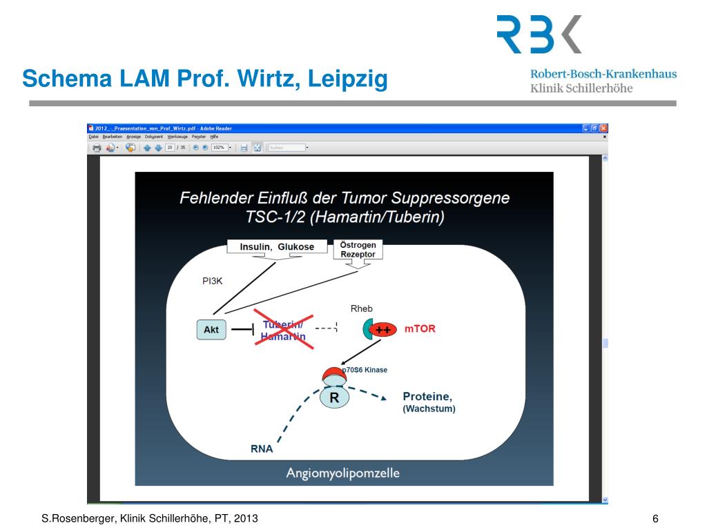 PPT - Lymphangioleiomyomatose (LAM) Physiotherapie bei LAM Stefanie ...