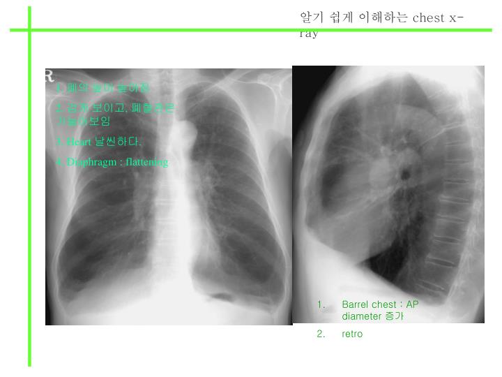 Chest X Ray Powerpoint