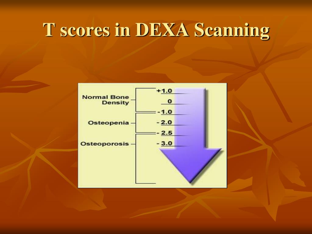 Osteoporosis T Score Chart