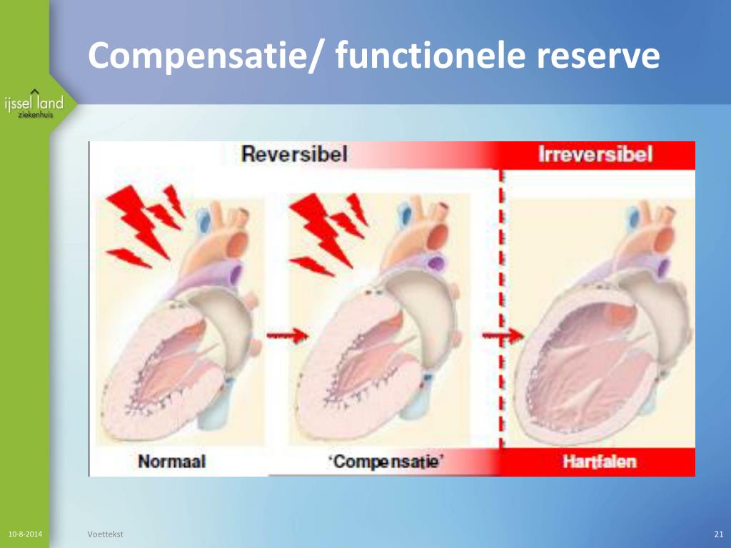PPT - De rek is eruit Cardiotoxiciteit bij chemotherapie Michel Boom M