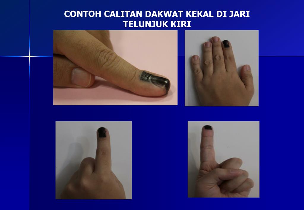 Dakwat Mengundi Nama Kimia / Dakwat ditandakan di jari telunjuk kiri