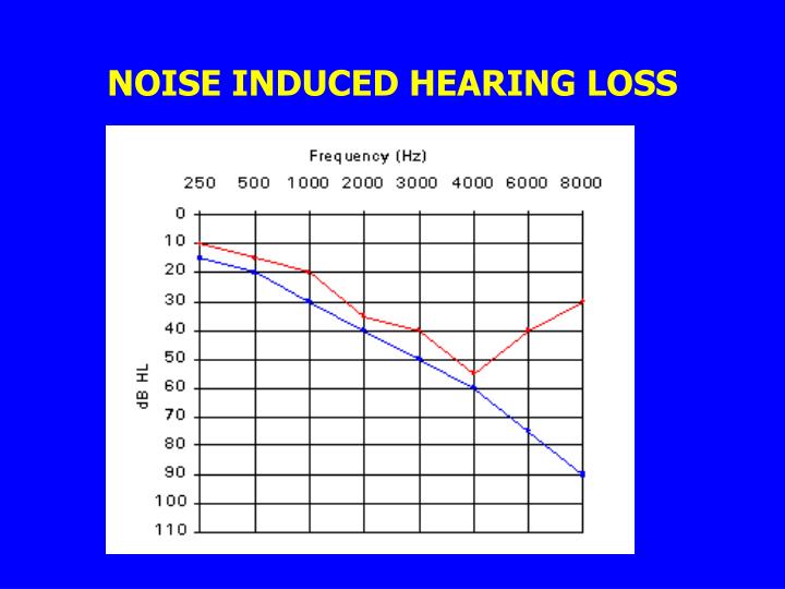 ppt hs 471 noise pollution chapter 13 powerpoint noise induced hearing loss