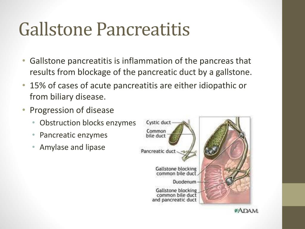 case study of pancreatitis