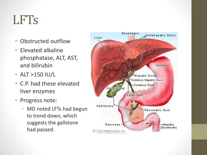 PPT Clinical Case Study Acute Pancreatitis PowerPoint Presentation