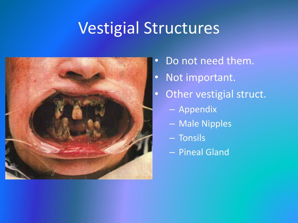 download vestigial structures download vestigial structures