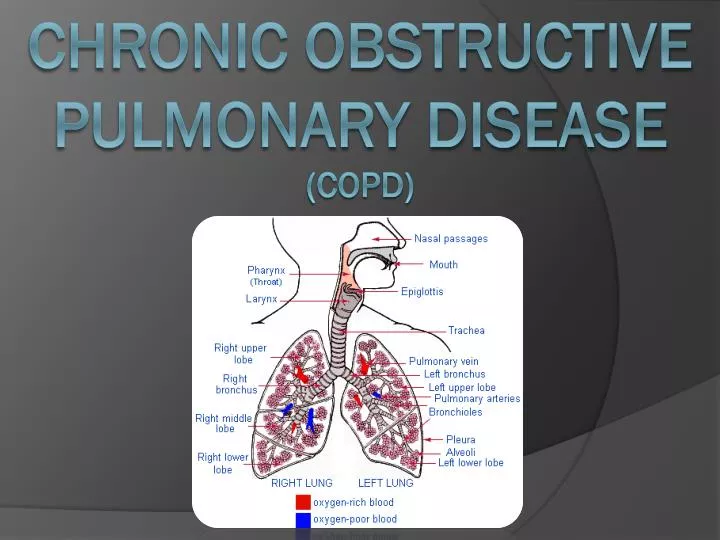 chronic obstructive pulmonary disease copd n.