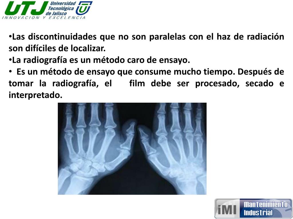 PPT - Ventajas y desventajas de los rayos X PowerPoint Presentation