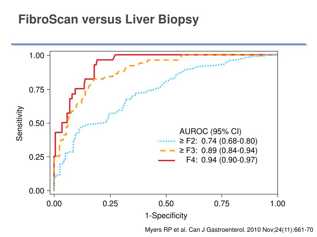 PPT - Case Study on Treatment-Naive Chronic Hepatitis C: Insights into