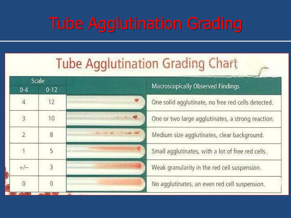 Agglutination Grading Chart