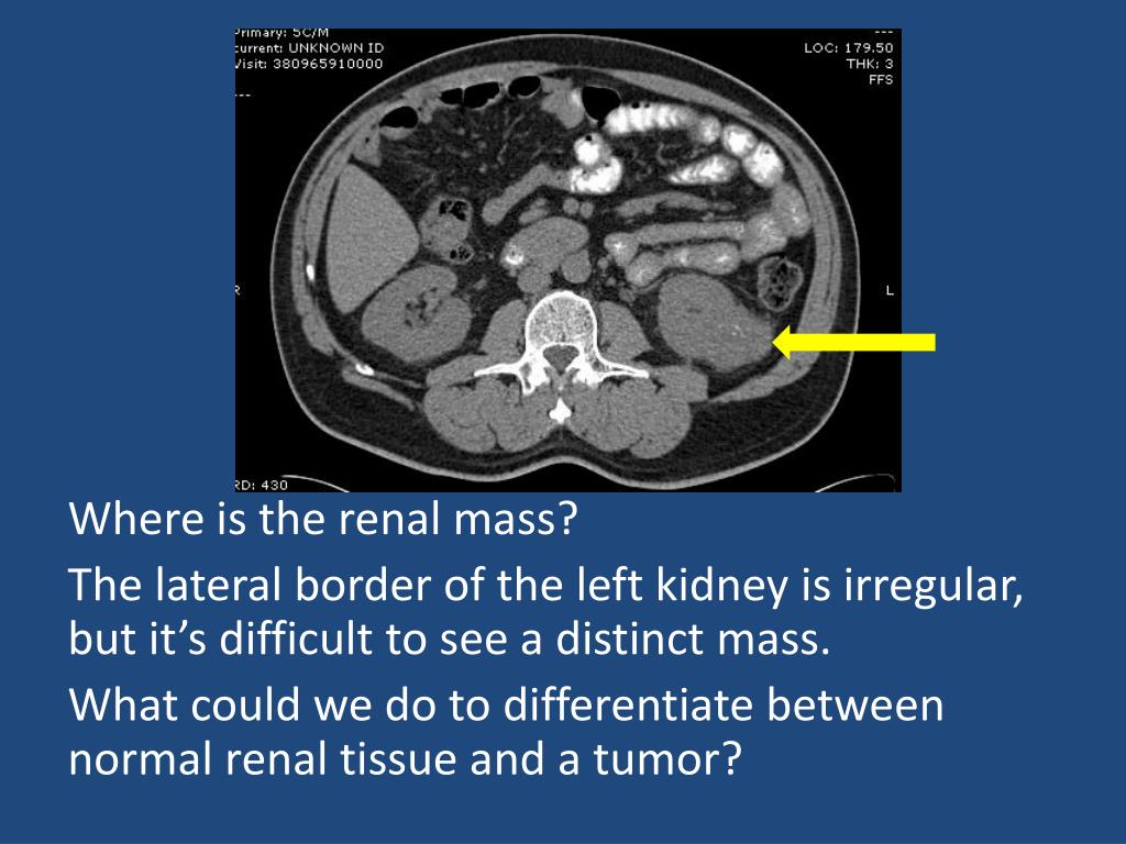 PPT - Uroradiology For Medical Students PowerPoint Presentation, free ...
