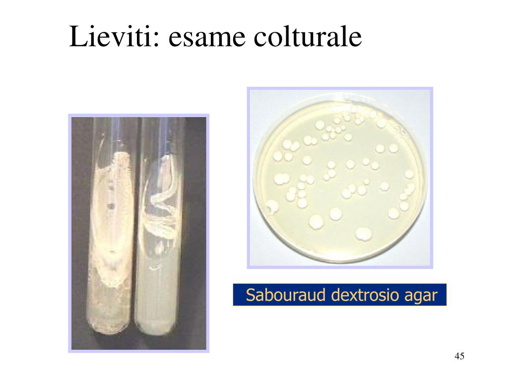 PPT - Analisi microbiologica dei campioni PowerPoint Presentation, free