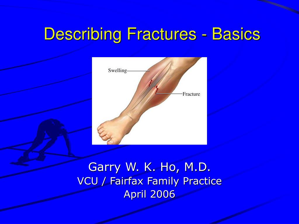 PPT - Describing Fractures - Basics PowerPoint Presentation, free