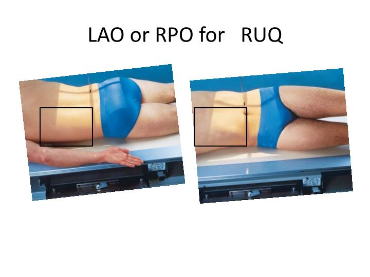 PPT - Lab Positioning for GU SYSTEM IVP & Cysto & ERCP PowerPoint ...