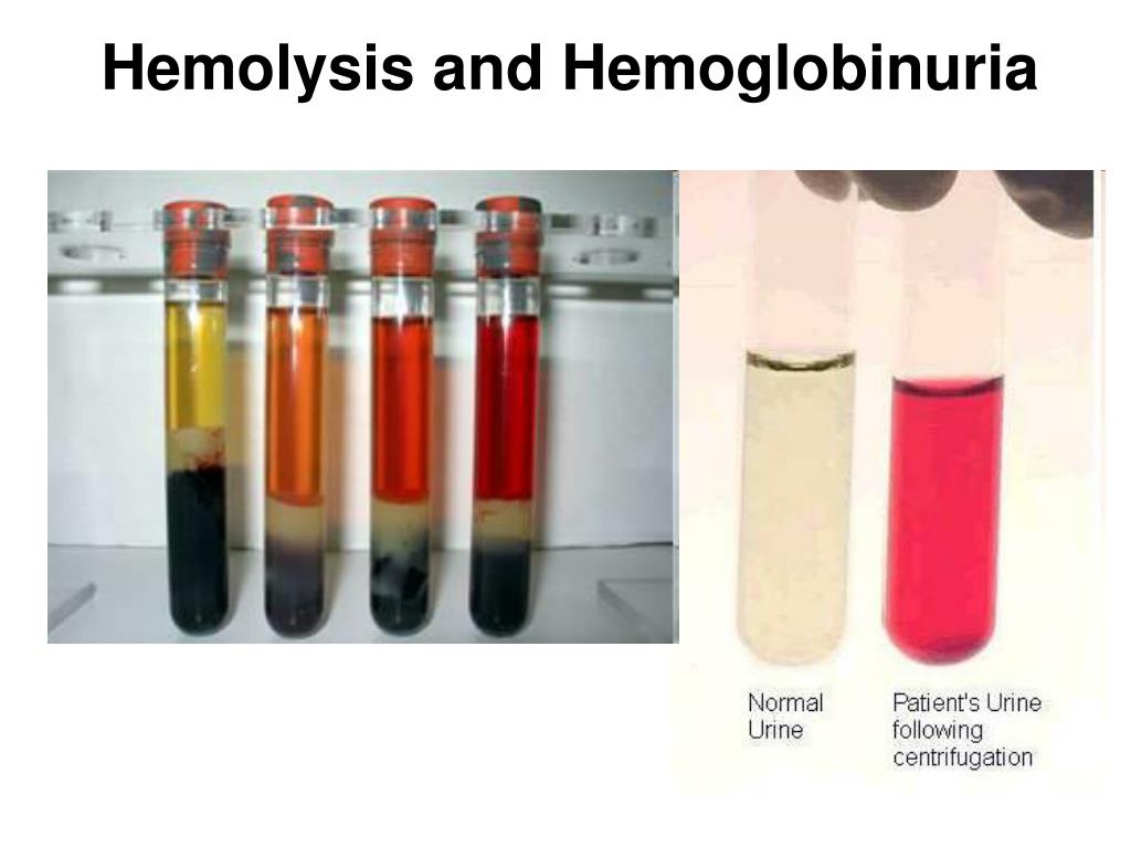 PPT Pigments and accumulations PowerPoint Presentation, free download