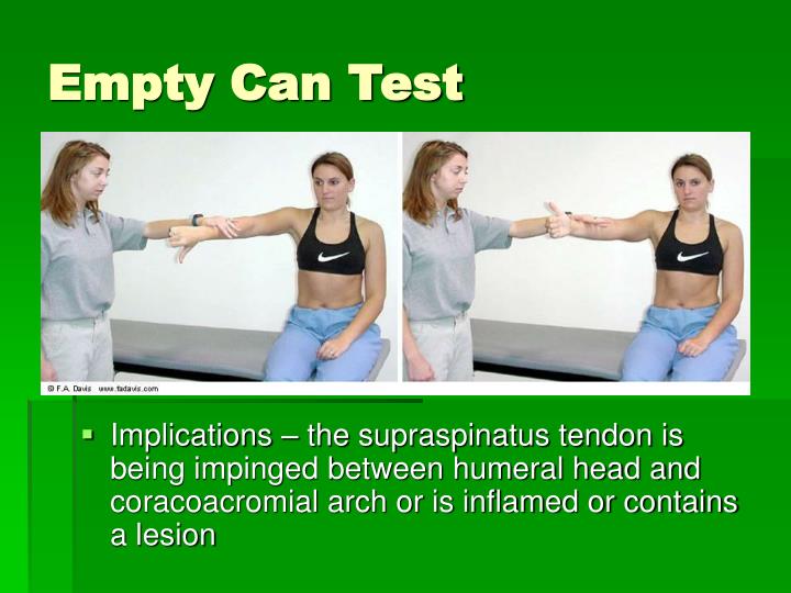 Empty Can Position PPT - Ch. 13 – The Shoulder and Upper Arm PowerPoint Presentation - ID ...
