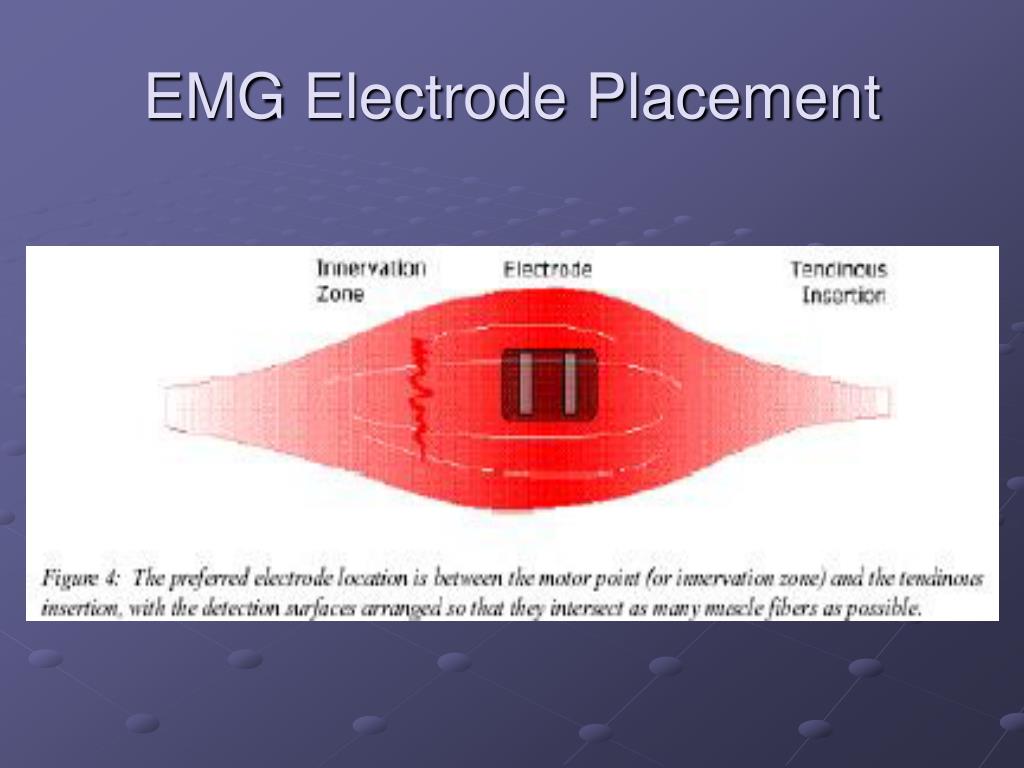 Emg Electrode Placement Chart