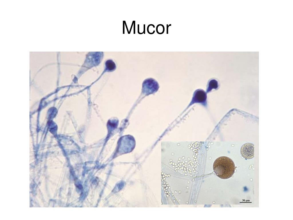 Мукор клетка. Грибы рода мукор. Мукор под микроскопом микробиология. Грибы рода Mucor. Грибок мукор.