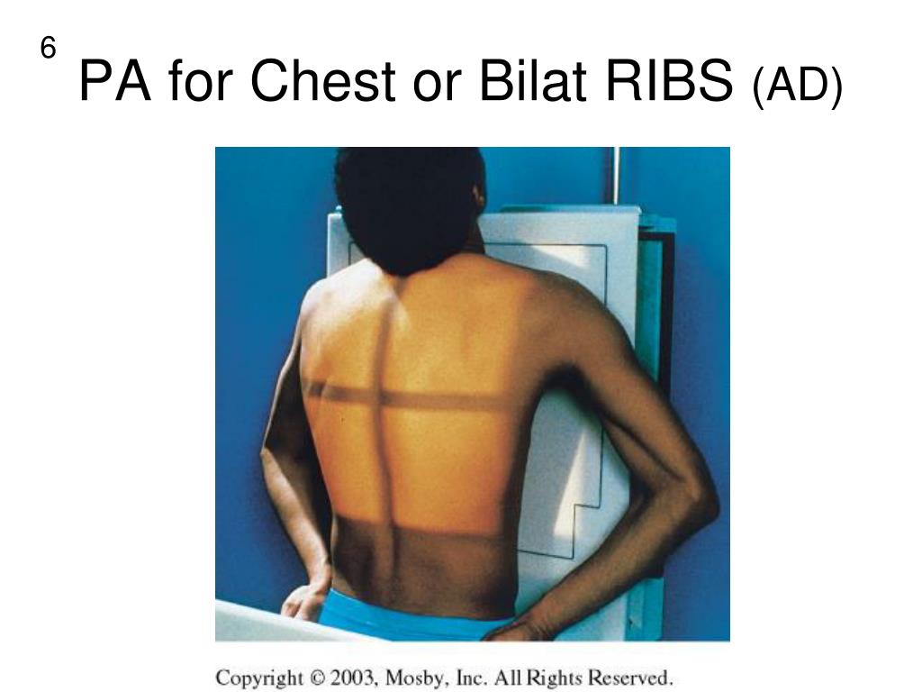 PPT - PA -anterior side BEST SEEN AP -posterior side BEST SEEN ...