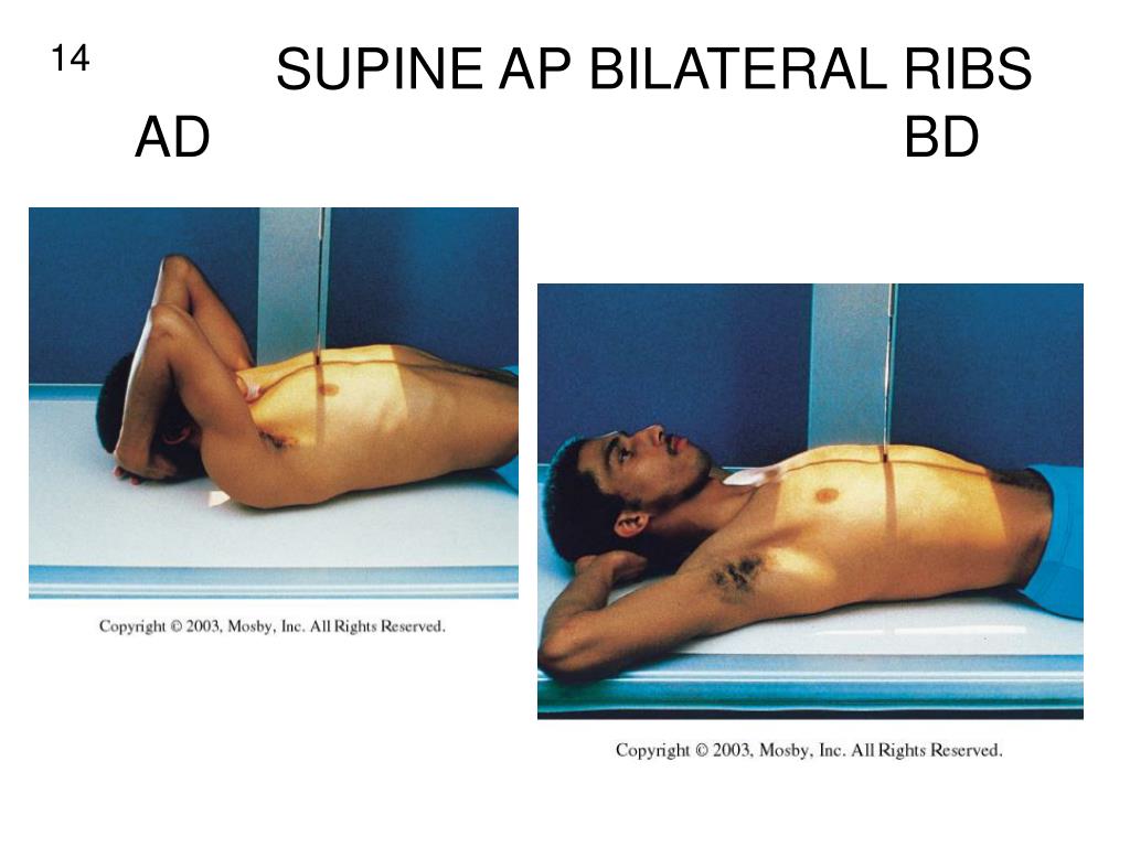 PPT - PA -anterior side BEST SEEN AP -posterior side BEST SEEN ...