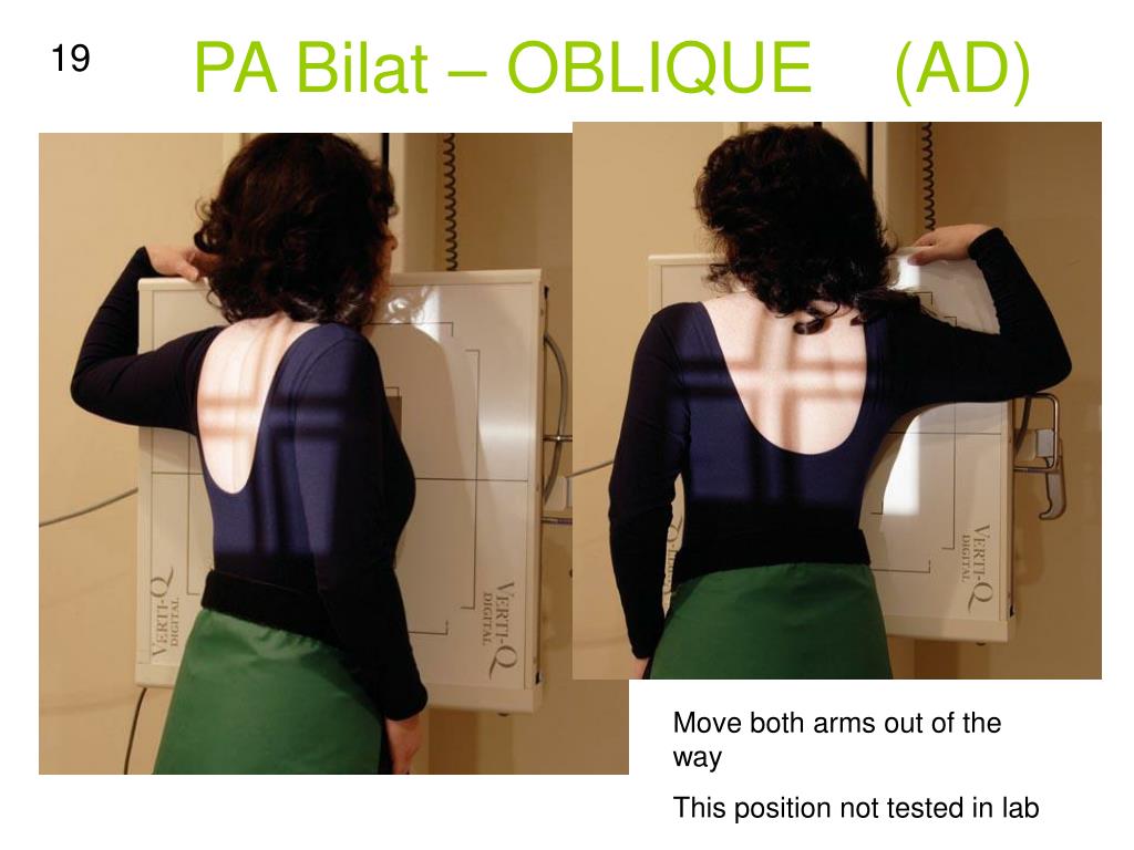 Lao Vs Rpo Ribs PPT - PA -anterior side BEST SEEN AP -posterior side BEST SEEN ...