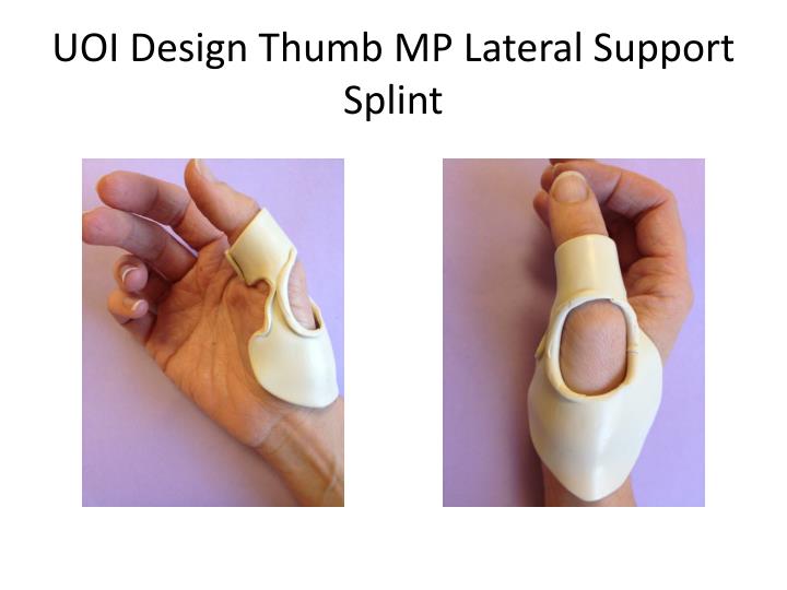 PPT - Innovative Splinting options for the Thumb MP joint PowerPoint ...