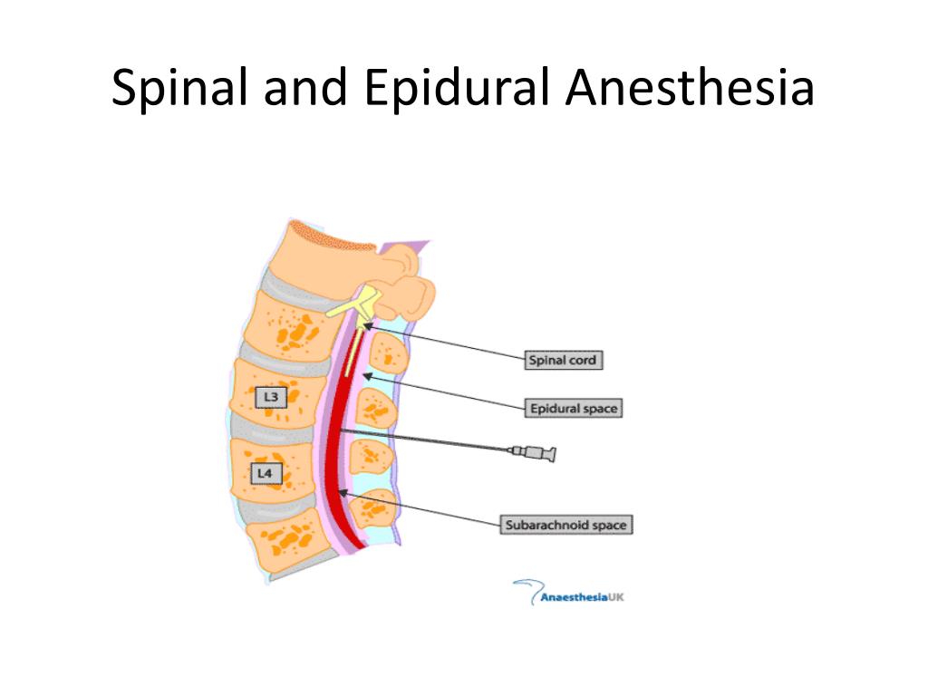 PPT OB Anesthesia PowerPoint Presentation Free Download ID 3208585 PPT OB Anesthesia PowerPoint Presentation Free Download ID 3208585