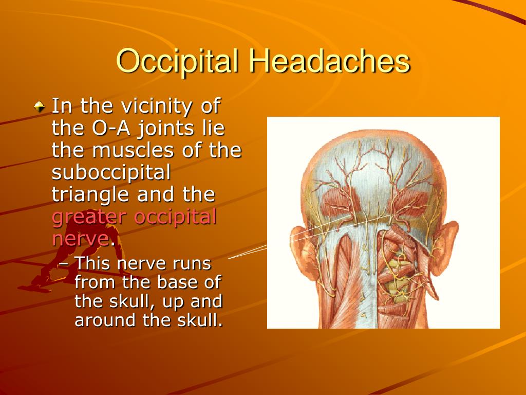 Ppt Occipital Headaches Occipital Neuralgia Powerpoint Presentation