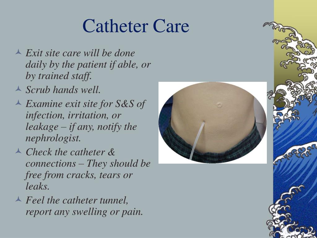 PPT CARE OF THE HOSPITALIZED PERITONEAL DIALYSIS PATIENT PowerPoint
