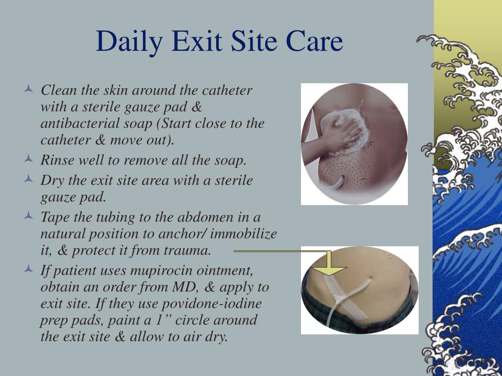 PPT CARE OF THE HOSPITALIZED PERITONEAL DIALYSIS PATIENT PowerPoint
