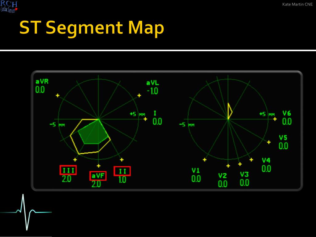 makemkv segment map inside out makemkv segment map inside out