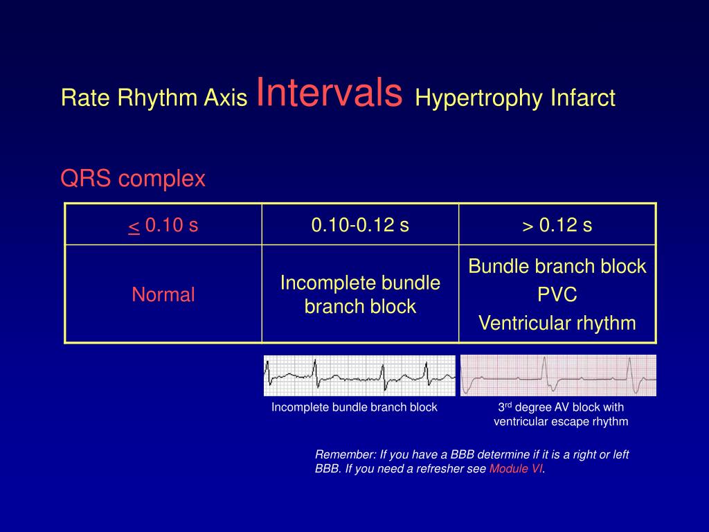 PPT - ECG Rhythm Interpretation PowerPoint Presentation, free download ...