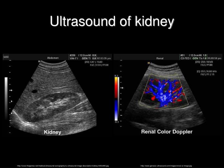 PPT - Urinary system Systema urinarium Kidneys Renes PowerPoint ...