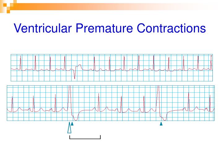 PPT - Ulkumen Rodoplu, MD EuSEM PowerPoint Presentation - ID:3257106