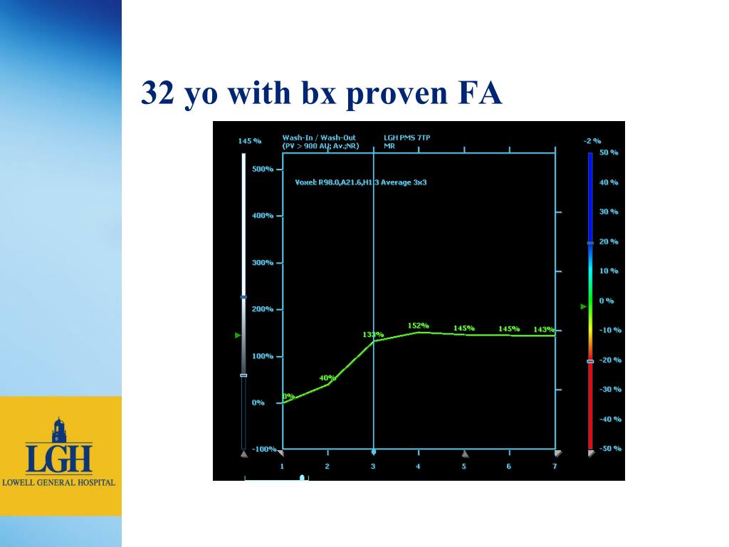 PPT - Breast MRI at Lowell General Hospital PowerPoint Presentation ...