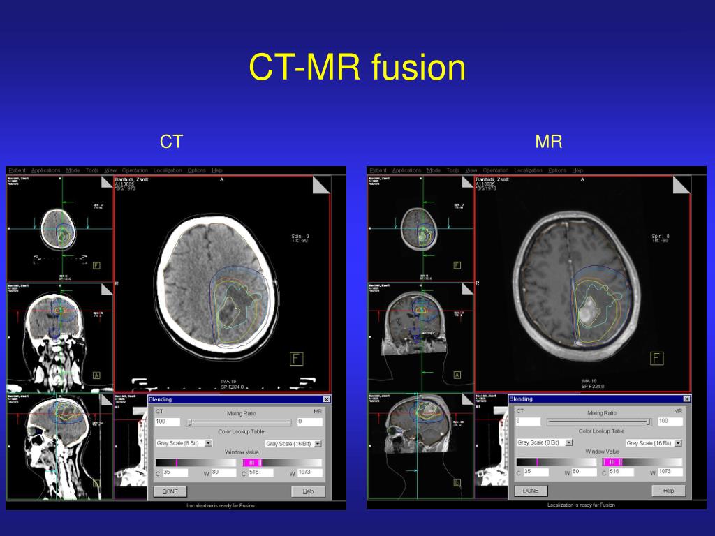 PPT - Virtual Simulation in the Radiooncology Department of B-A-Z ...