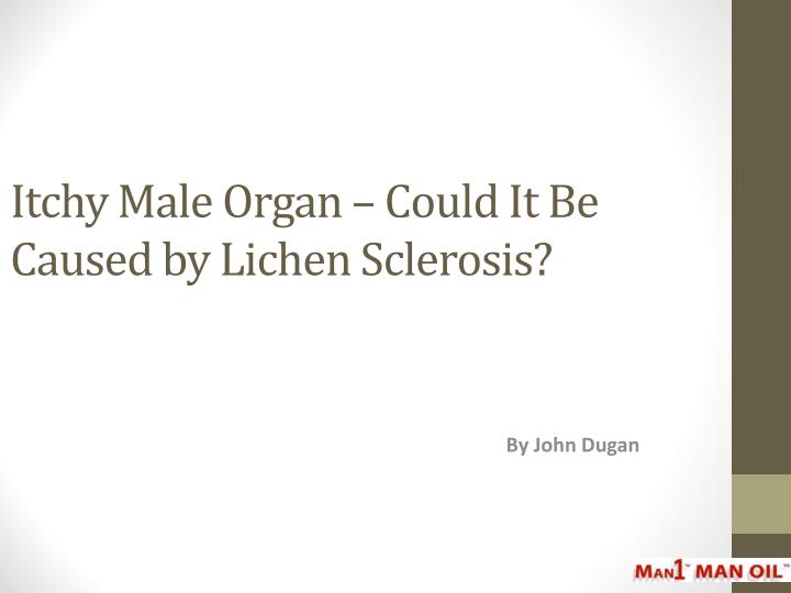 itchy male organ could it be caused by lichen sclerosis n.